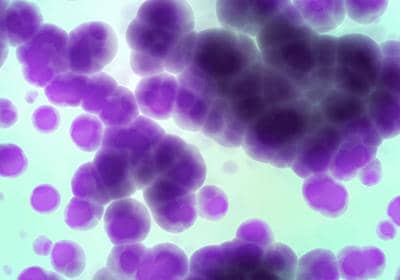 穩定細胞株和穩定細胞系的區別體現在哪些方面?